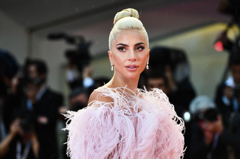 Lady Gaga offers $500,000 for return of dogs after thief steals them, shoots dog walker