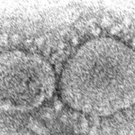 Dominant coronavirus mutant contains ghost of pandemic past | AP News