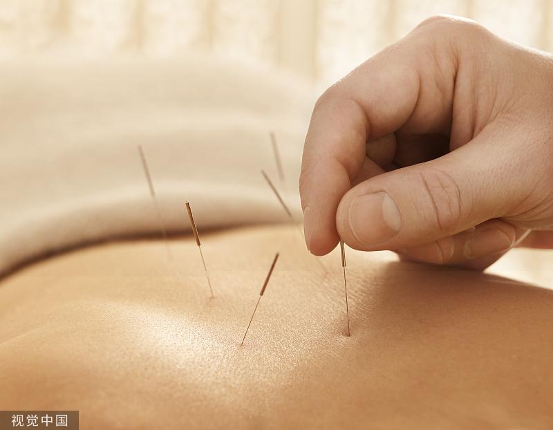 Chinese acupuncture reduces pain, anxiety in cancer surgery: Study