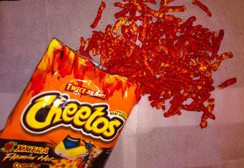 Hot Cheetos and Takis under fire after snacking teen needs gallbladder removal