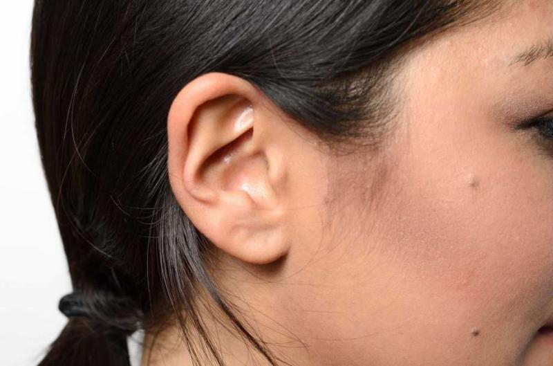 Woman can't hear men with deep voices due to rare condition