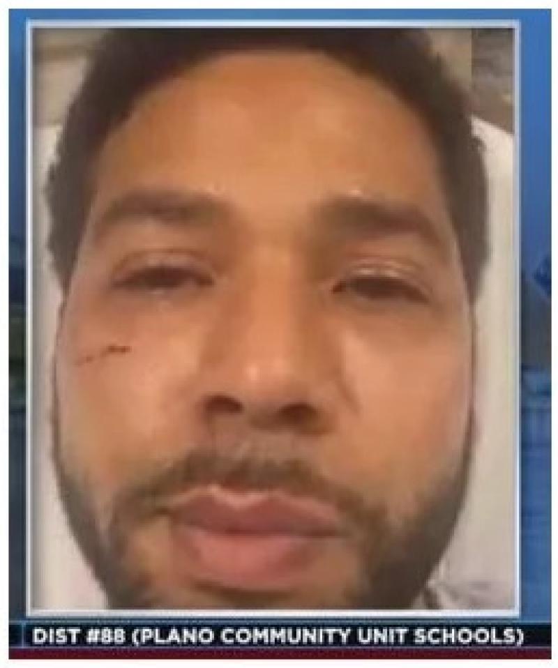 Empire’ Actor Jussie Smollett Orchestrated Attack, Source Says