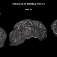 ‘Partly Alive’: Scientists Revive Cells in Brains From Dead Pigs