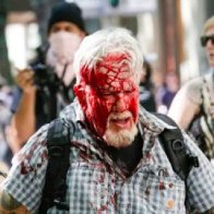 Two more Oregon men left bloody after violent antifa attack at Portland protest