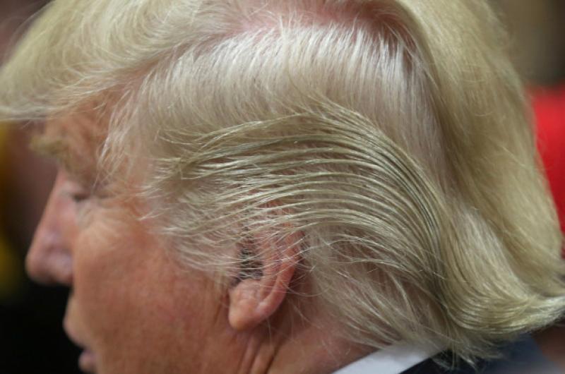 Trump’s bizarre hairdo finally explained