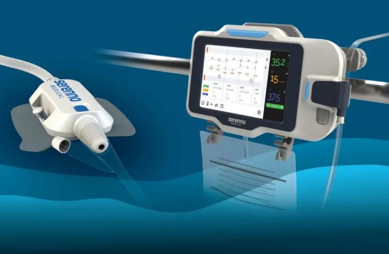 Israeli tech firm develops life-saving automatic kidney monitoring device