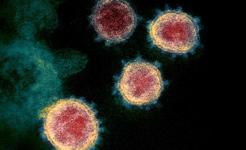 Where did the new coronavirus come from? Past outbreaks provide hints