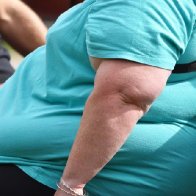 OBESITY ONE OF THE BIGGEST RISK FACTORS IN COVID-19 HOSPITALIZATIONS