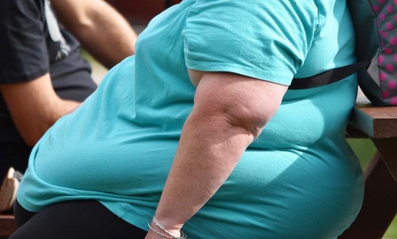 OBESITY ONE OF THE BIGGEST RISK FACTORS IN COVID-19 HOSPITALIZATIONS