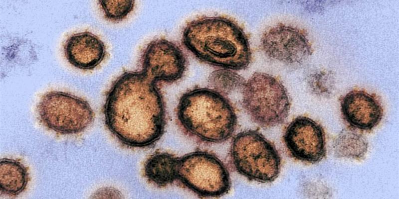 Why are viruses hard to kill? Virologists explain why these tiny parasites are so tough to treat
