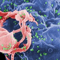 Tracing the global spread of AIDS