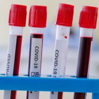 Your risk of severe COVID-19 may be affected by blood type, new genetic analysis suggests