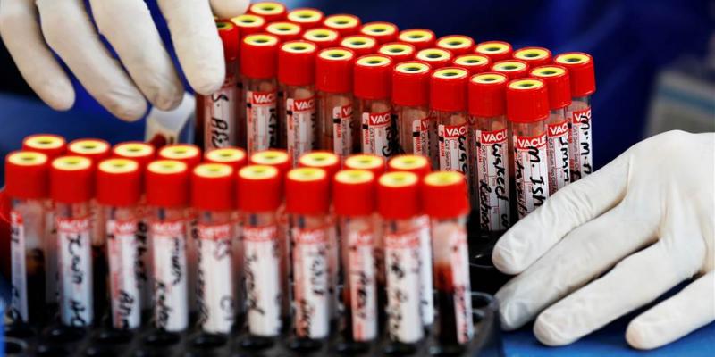 What's your blood type? It may affect your risk for Covid-19