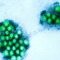 Norovirus spreading in 2023: Symptoms and how the virus transmits