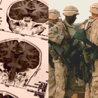 A Navy SEAL was convinced exposure to blasts damaged his brain, so he donated it to science to prove it