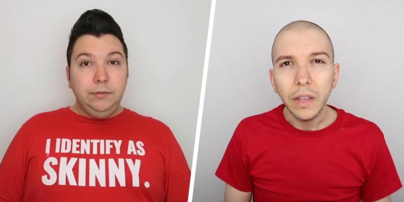 YouTuber Nikocado Avocado reveals surgery results months after weight loss shocks internet