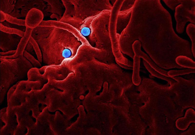 What happens when two different respiratory viruses infect the same cell?