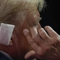 OPINION: Donald Trump cannot be the sole medical source on the ear injury