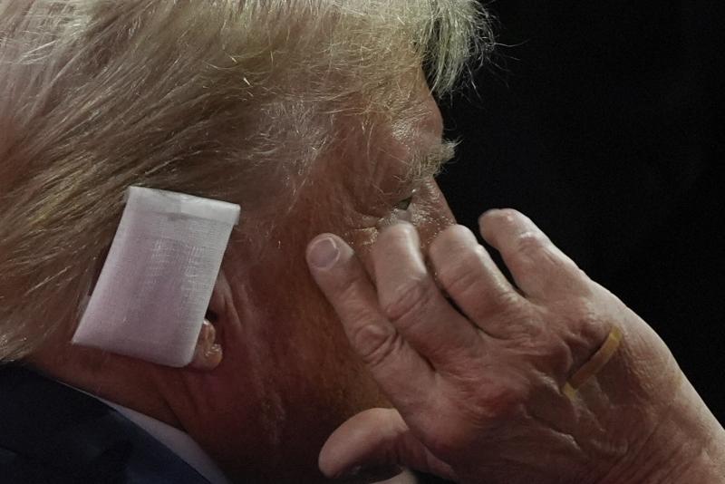 OPINION: Donald Trump cannot be the sole medical source on the ear injury