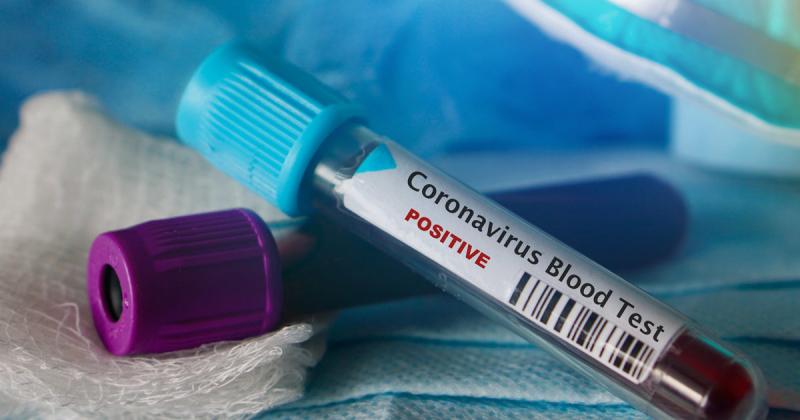 Politicizing the Coronavirus Outbreak